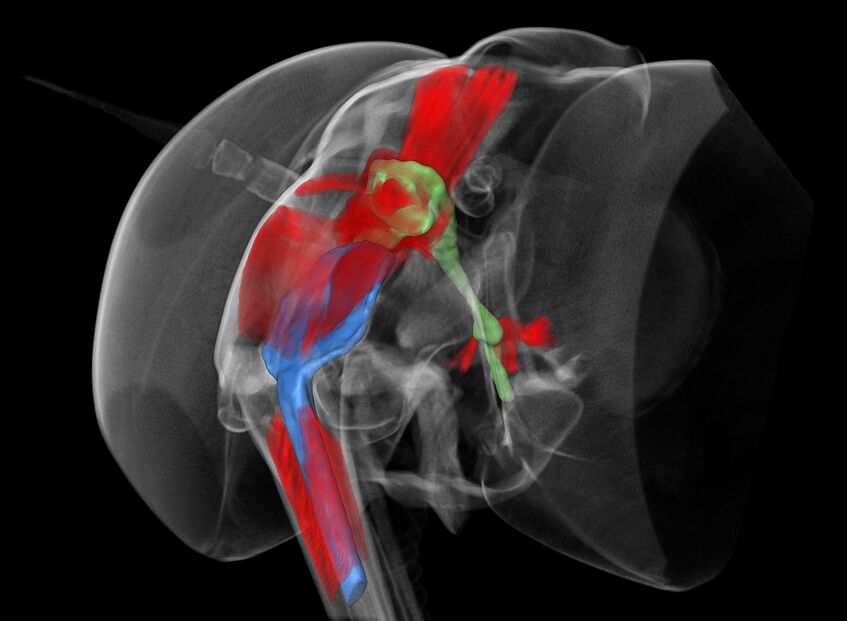 Colored X-ray.